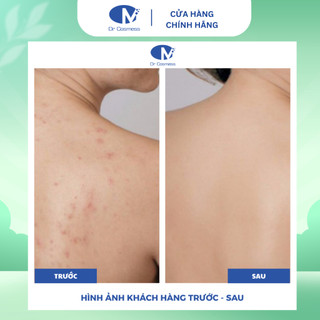 Xịt Giảm Mụn Lưng, Mụn Body ClearBack, Giúp Sạch Sâu Lỗ Chân Lông, Ngăn Mụn Trở Lại 120ml Dr Cosmess