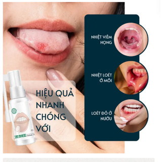 Xịt nhiệt miệng thảo dược giúp kháng khuẩn giữ cho khoang miệng luôn sạch sẽ thơm tho 30ml