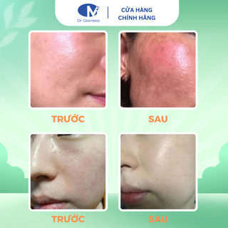 Nước Tẩy Trang Sạch Sâu, Lành Tính, Dịu Nhẹ, Loại Bỏ Bụi Bẩn Và Lớp Makeup Chính Hãng - Dr Cosmess