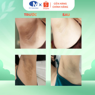 Muối Tẩy Tế Bào Chết Nách, Không Đau Rát, Dưỡng Sáng, Giảm Thâm, Giảm Mùi Dr Cosmess