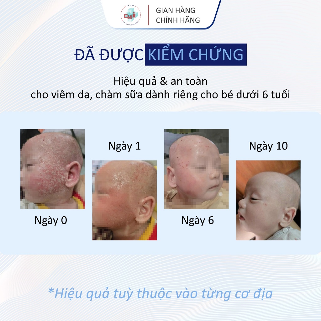 Blue Cap Cream 50g, Kem Bôi Viêm Da Cơ Địa Viêm Da Dị Ứng, Vảy Nến, Giảm Ngứa, Mẩn Đỏ, Dưỡng Ẩm, Làm Dịu Da