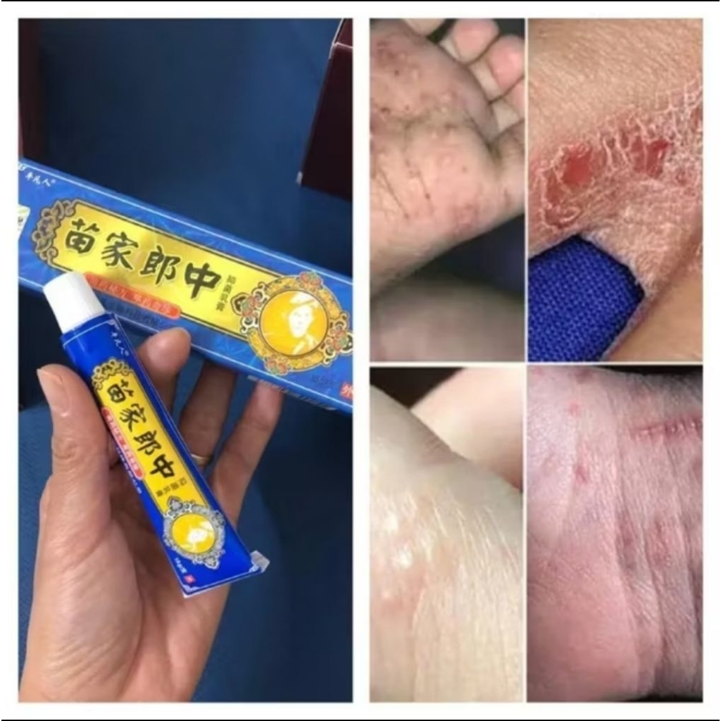 Kem Bôi Da Miếu Gia Viên - Dưỡng Da, Hỗ Trợ Các Vấn Đề Da Khô, Nám, Vảy Nến - Thảo Mộc Tự Nhiên 15g