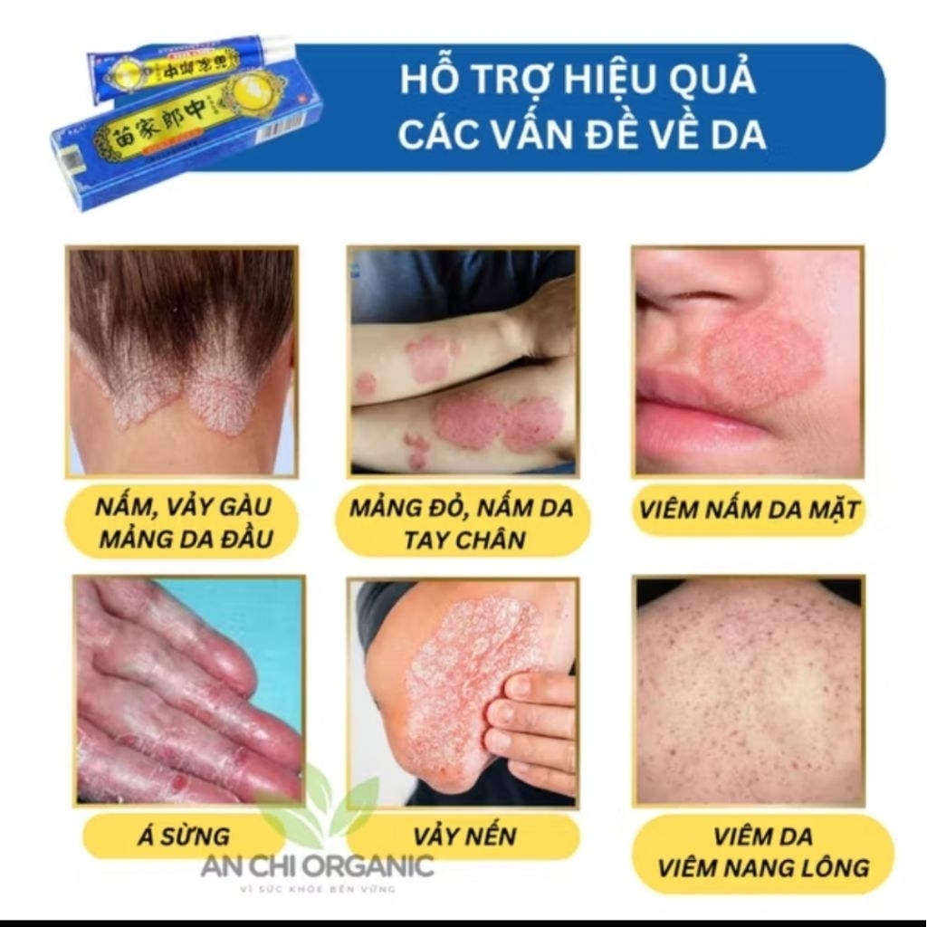 Kem Bôi Da Miếu Gia Viên - Dưỡng Da, Hỗ Trợ Các Vấn Đề Da Khô, Nám, Vảy Nến - Thảo Mộc Tự Nhiên 15g
