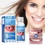 Keo tạo hình và trám răng South Moon 30ml, dùng tạm thời cho răng giả trong phim ảnh và các dịp khác