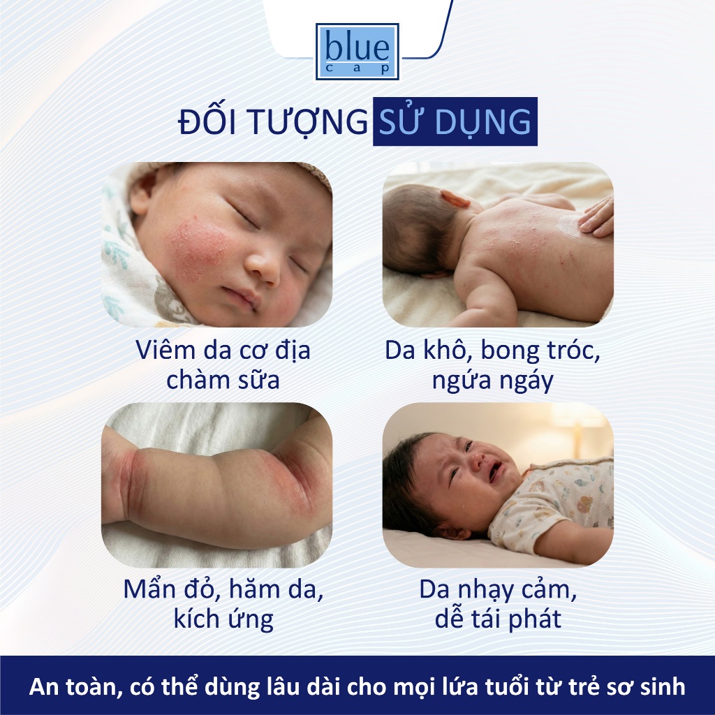 Kem Bôi Viêm Da Cơ Địa Blue Cap Cream 50g, Hỗ Trợ Giảm Viêm Da, Chàm Sữa, Ngứa Ngáy, Mẩn Đỏ