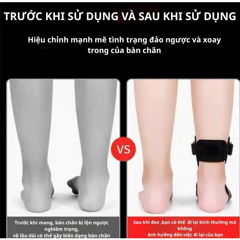 Nẹp Cố Định Bàn Chân Ban Đêm – Nẹp Chỉnh Bàn Chân, Giảm Đau Gót Chân