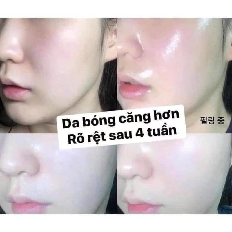 [Top 1 bán chạy] Sample Peel tái tạo da chuyên sâu CNP Rx Skin Intensive Peel