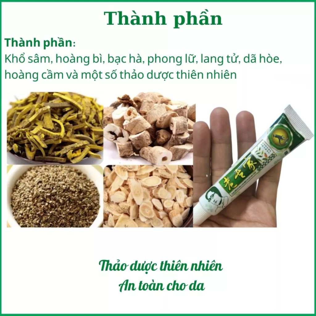 Kem bôi nấm ngứa|mề đay| tổ đỉa| hắc lào| lang ben| vảy nến| á sừng| viem da cơ địa| an toàn cho da| hộp 15Gr