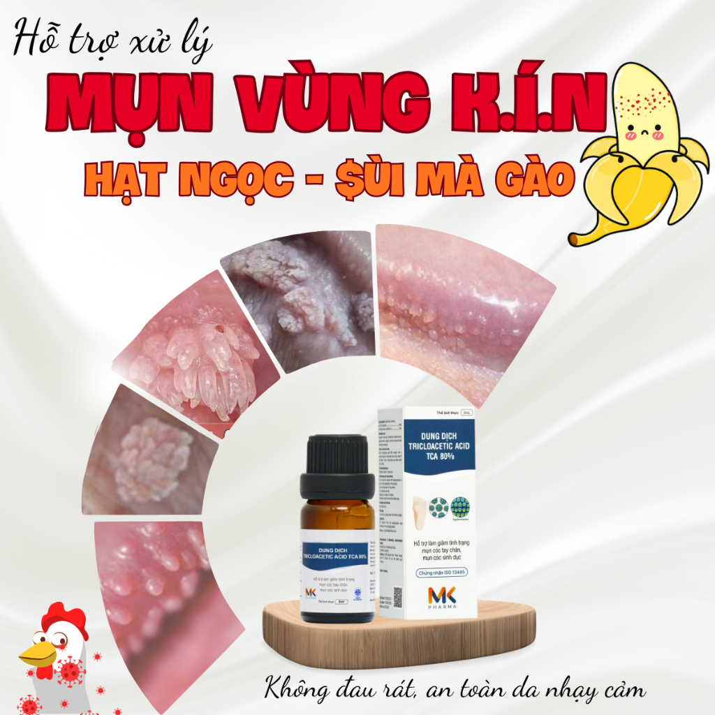 [MỤN VÙNG KÍN] Dung Dịch Xử Lý Hạt Ngọc, Sùi Mào Gà MK TCA ( Che Tên )