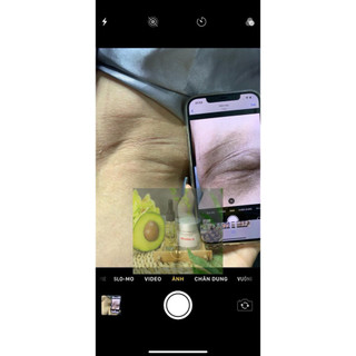 Bộ 3 Peel dưỡng trắng