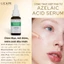 LICAPE AZELAIC ACID SERUM - Serum Axit Azelaic giảm Mụn, mờ thâm, kiểm soát dầu nhờn