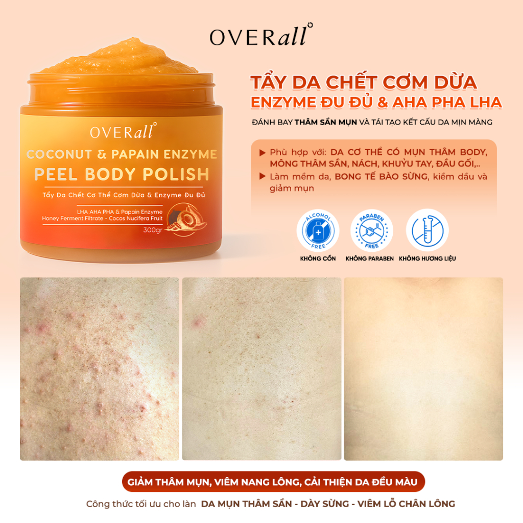 Combo 3 Tẩy Da Chết Body Cơm Dừa Cho Da Mụn, Viêm lỗ chân lông OVERall – Giúp Da Sạch mụn, Căng Bóng