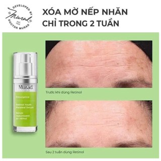 Retinol Hỗ Trợ Da Căng Bóng Và Làm Mờ Nếp Nhăn Trên Da Murad Retinol Youth Renewal Serum