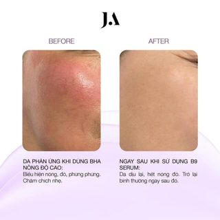 Tinh Chất Hỗ Trợ Phục Hồi Da Và Làm Dịu Da Juliette Armand Elements Folic Acid (B9) Serum