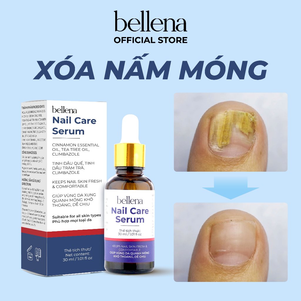 Serum nấm móng tay chân dưỡng cứng dài móng an toàn và hiệu quả Bellena Nail Care Serum