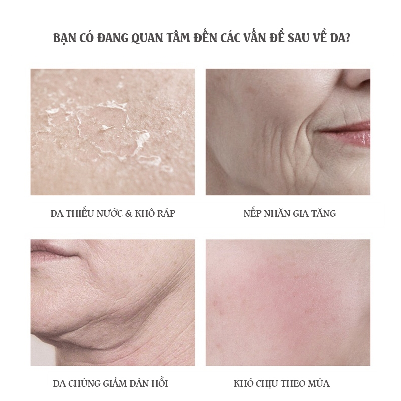 【 Mua 1 Tặng 4】Sữa Dưỡng Tinh Chất Botox Collagen Trẻ Hóa Da 120g - Dưỡng Ẩm, Làm Mềm, Giảm Nhăn  Không Kích Ứng