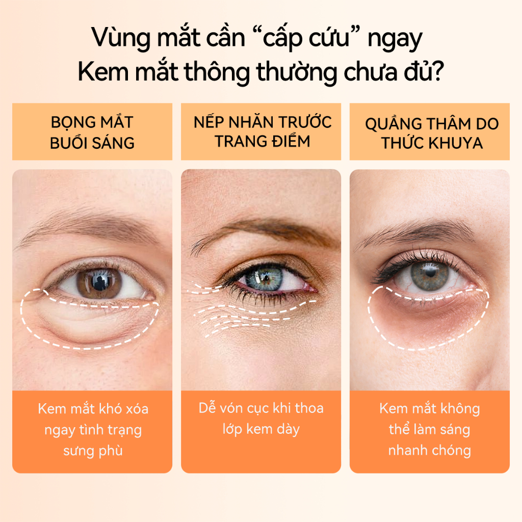 LANBENA COMBO Kem mắt+mặt nạ mắt  retinol (15ml+60 miếng) - giúp săn chắc, giảm bọng mắt, giảm nhăn trẻ hóa Skincare