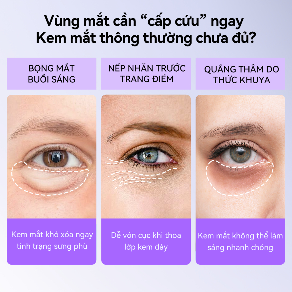 LANBENA Mặt Nạ Mắt Retinol/Vitamin C (Hộp/60 miếng) - Hỗ Trợ Trẻ Hóa, Giảm Nhăn, Làm Mờ Quầng Thâm Mắt Skincare