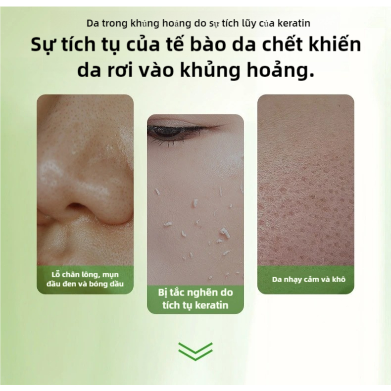 Gel Tẩy Tế Bào Chết 120g TẨY DA CHẾT làm sạch lớp da sần sùi, giúp da thông thoáng mịn màng
