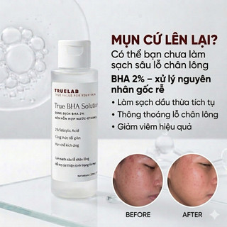 [100ml] Toner True BHA Solution 2% Salicylic Acid Giúp Giảm Mụn Viêm Mụn Đầu Đen Sợi Bã Nhờn Thông Thoáng True Lab