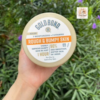 Kem dưỡng thể Gold Bond Rough & Bumpy Skin