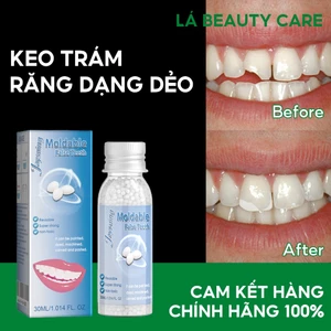 Bộ dụng cụ sửa răng tạm thời 30ML Keo dán có thể tạo hình để lấp đầy khoảng trống Chăm sóc răng giả