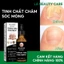 EELHOE Tinh chất nấm móng Serum Tẩy Nấm Móng Tay Chân Loại Bỏ Nấm Móng Dưỡng Móng Phục Hồi Móng