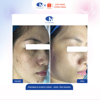 Mặt Nạ Giấy Dr Cosmess Cystelasma Cấp Ẩm Phục Hồi, Mờ Nám Tàn Nhang Cao Cấp Chính Hãng ( 1 miếng)
