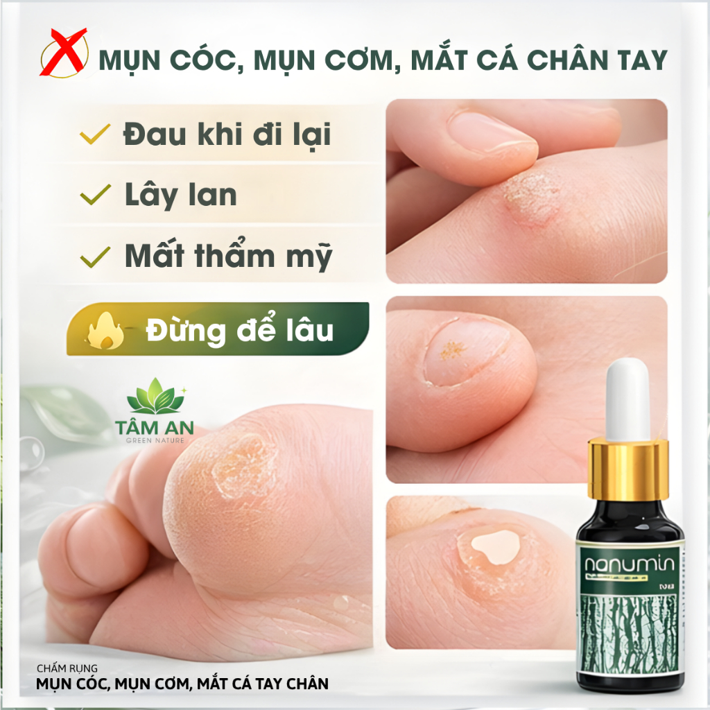 Tinh Chất Chấm Rụng Mụn Cóc, Mụn Cơm, Mụn Thịt, Mắt Cá Chân Lâu Năm [Nanumin 15ML]