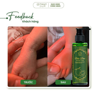 Dầu dừa Massage Cho Bé Thuần Chay Chiết Xuất Dừa Hãng Home Care, Massage Bé, Cho Mẹ Bầu, Sau Sinh