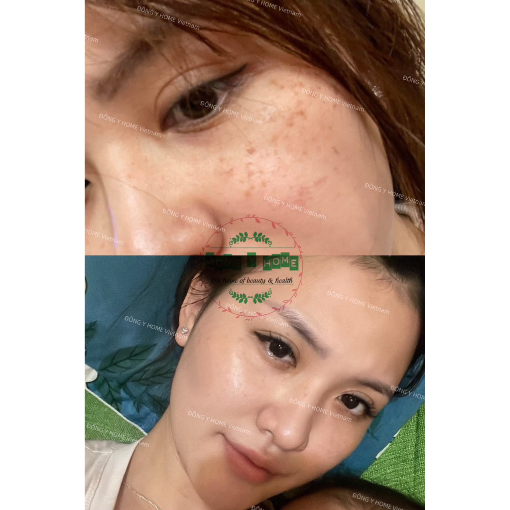 Kem Chấm Nám, Tàn Nhang Đông Y Home 20g: Hỗ Trợ Cải Thiện Thâm, Làm Đẹp Da, Skincare