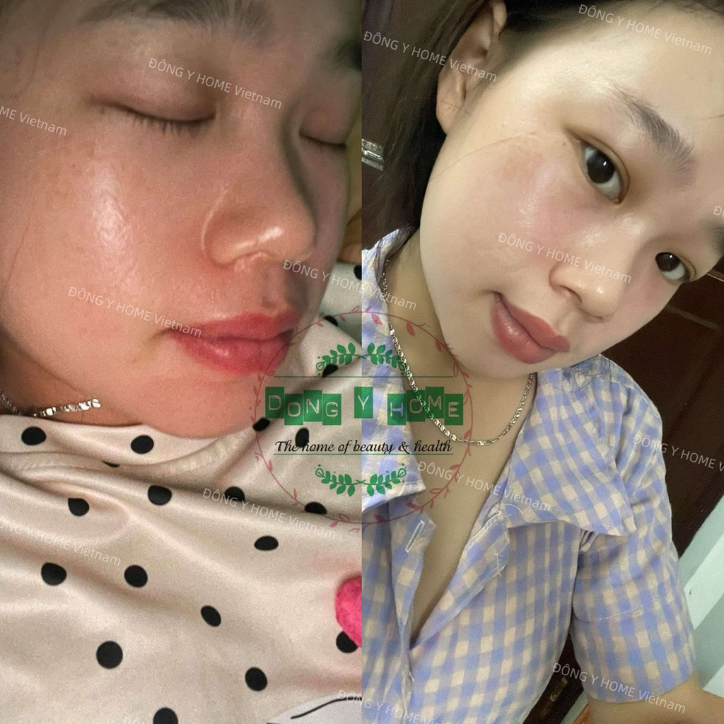 Kem Chấm Nám, Tàn Nhang Đông Y Home 20g: Hỗ Trợ Cải Thiện Thâm, Làm Đẹp Da, Skincare