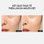 Theramid Smoothing Treatment 30ml, Phức Hợp Peel Da Với Axit Nhẹ, Phục Hồi Da