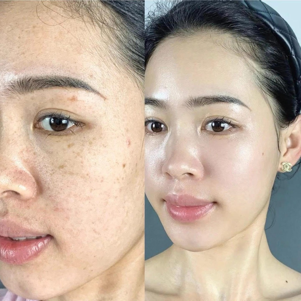 Combo 2 Hộp Srum 377 Tinh Chất Làm Trắng Niacinamide Hỗ Trợ Giảm Thâm Nám Cải Thiện Da Sỉn Màu Dưỡng Ẩm Sâu