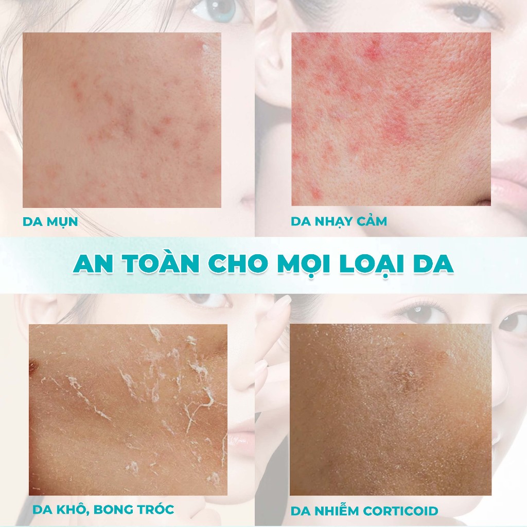 Sữa Rửa Mặt Chăm Sóc Chuyên Sâu Da Mụn & Tổn Thương Mincer Pharma Hyaluron Facial Cleansing Gel 405 200ml