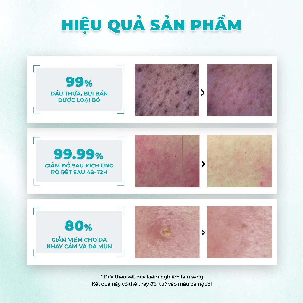 Sữa Rửa Mặt Chăm Sóc Chuyên Sâu Da Mụn & Tổn Thương Mincer Pharma Hyaluron Facial Cleansing Gel 405 200ml