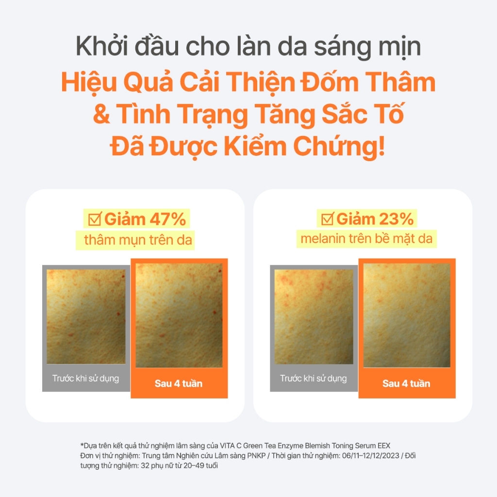 INNISFREE x KOL serum Vitamin C sáng da, mờ thâm mụn INNISFREE Green Tea Enzyme Brightening Serum 30ml