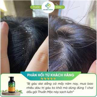 Combo Kem bôi da Thuần Mộc và Dầu gội đầu Thuần Mộc hỗ trợ bôi nấm đầu, nhiều gàu