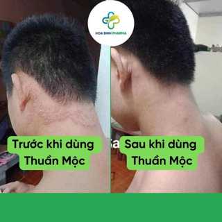 Combo Kem bôi da Thuần Mộc và Dầu gội đầu Thuần Mộc hỗ trợ bôi nấm đầu, nhiều gàu