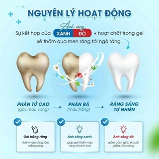 Máy Làm Trắng Răng SMILEKIT S5, Tặng 4 Bút Gel Làm Trắng Răng , Loại Bỏ Các Vết Ố An Toàn, Hiệu Quả, Không Ê Buốt