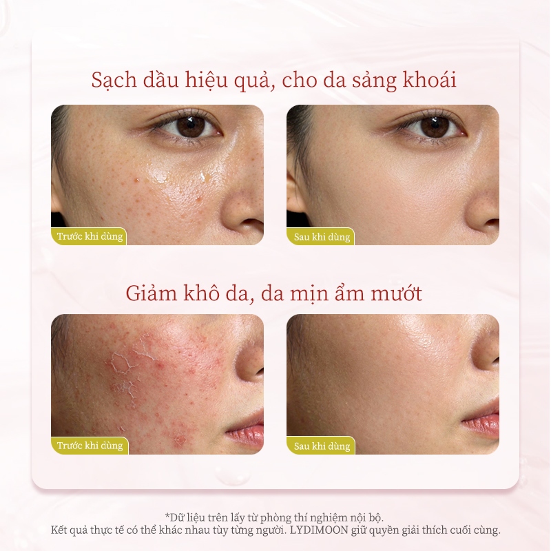 Sữa rửa mặt tẩy trang LYDIMOON Niacinamide kiềm dầu làm sạch sâu dưỡng ẩm dịu nhẹ xóa mụn giảm vàng da sáng da 100g