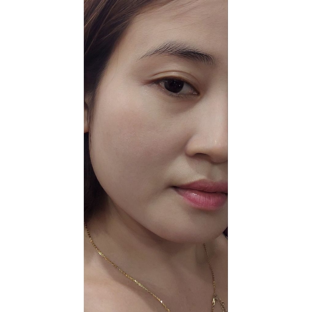 Bộ Cao Sâm Linh Chi Điêu Tri Mụn Nám Cao Cấp Mộc Nhân
