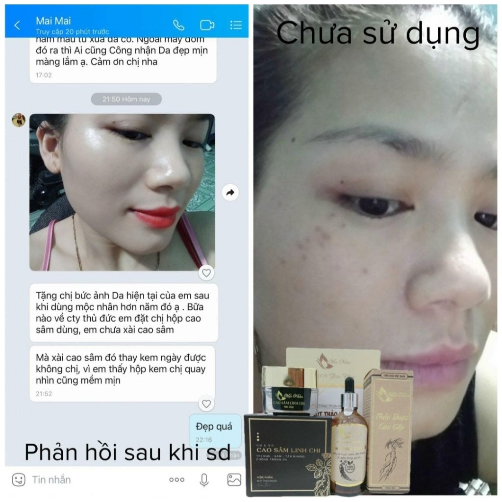Bộ Cao Sâm Linh Chi Điêu Tri Mụn Nám Cao Cấp Mộc Nhân