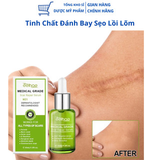 Combo 2 lọ Kem Xóa Sạch Sẹo Thâm, lấp đầy Sẹo Rỗ, Sẹo Lồi Lõm