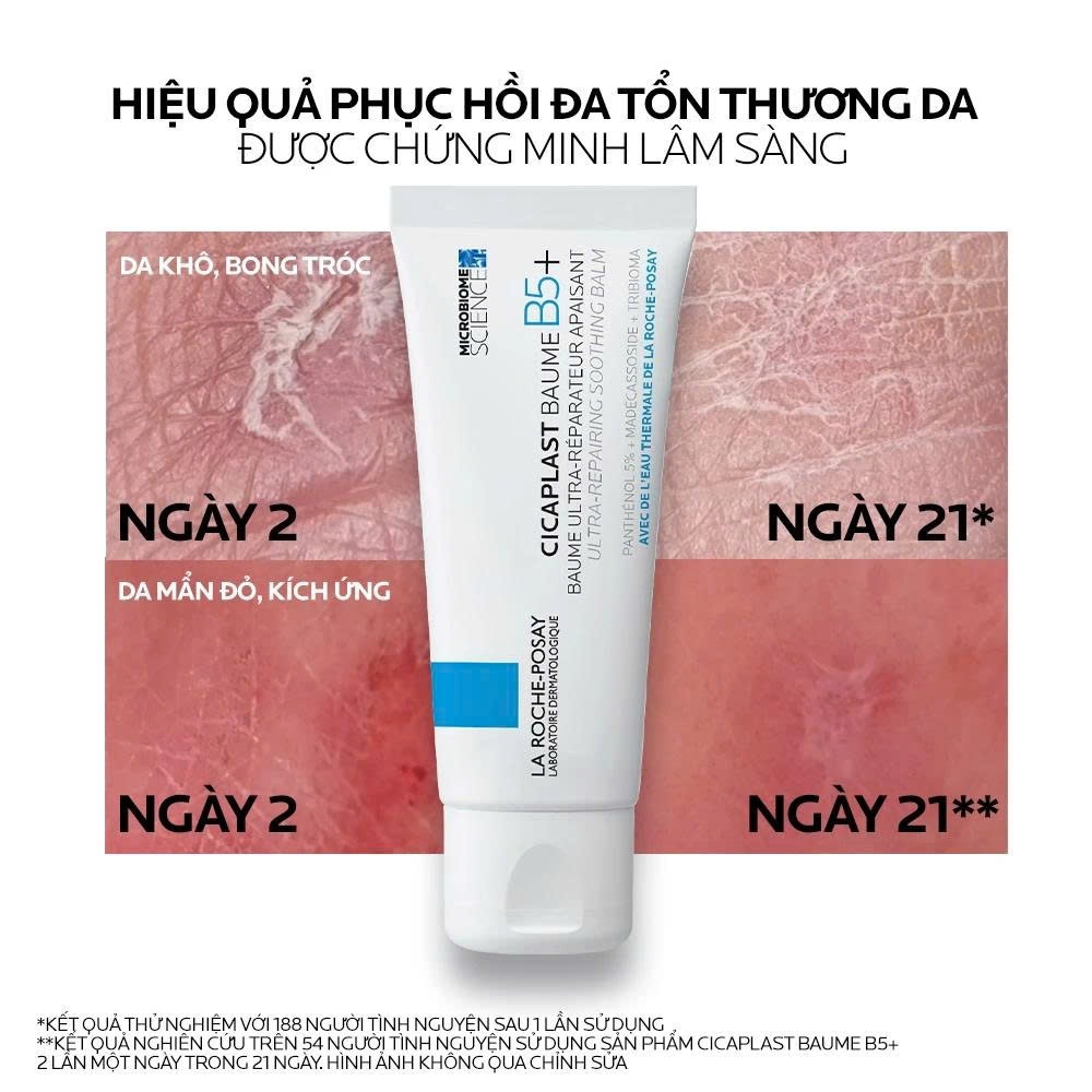 Kem dưỡng ẩm & phục hồi đa năng La Roche-Posay Cicaplast Baume B5+ giúp phục hồi da sau 1 lần sử dụng