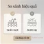 【Còn hàng】SK-II Facial Treatment Essence 30ml Nước dưỡng ẩm cao cấp bán chạy nhất của SK2 Nước dưỡng