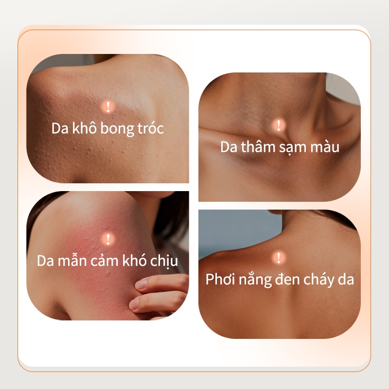 LYDIMOON Sữa dưỡng thể Niacinamide, Dưỡng sáng, cấp ẩm, chống nắng SPF 30, làm mềm mịn toàn thân, mượt như lụa 100g