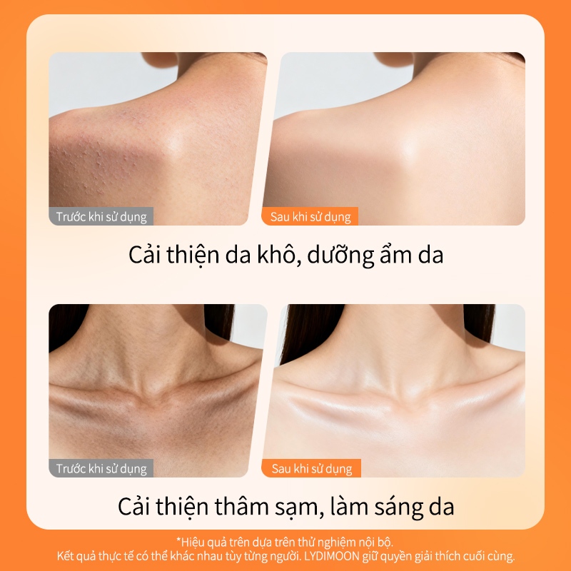 LYDIMOON Sữa dưỡng thể Niacinamide, Dưỡng sáng, cấp ẩm, chống nắng SPF 30, làm mềm mịn toàn thân, mượt như lụa 100g