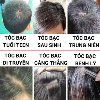 Dầu gội giảm tóc bạc Hà Thủ Ô Linh Chi Đen 300g - Dưỡng tóc đen, chắc khoẻ, mượt tự nhiên