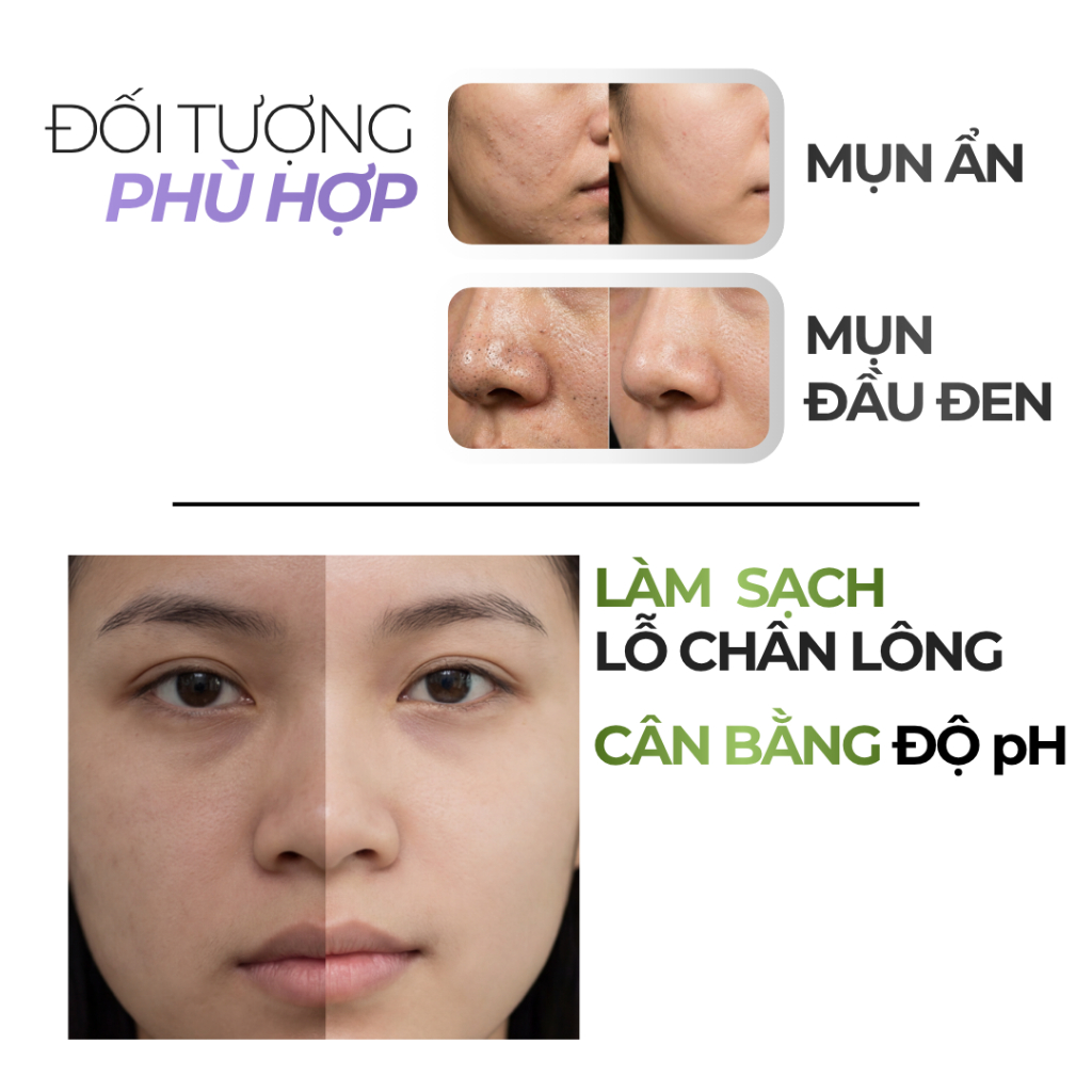 Serum B3 10% Niacinamide Dưỡng Sáng, Mờ Thâm, Phục Hồi Da Tổn Thương Do Ánh Nằng 30ml